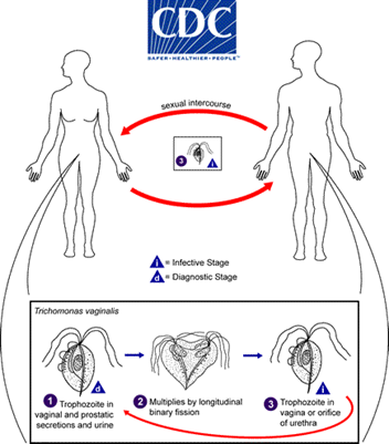 Trichomoniasis (Trich) Trichomoniasis (Trich)