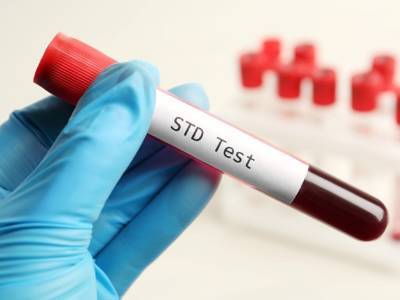 Testing STI Testing
